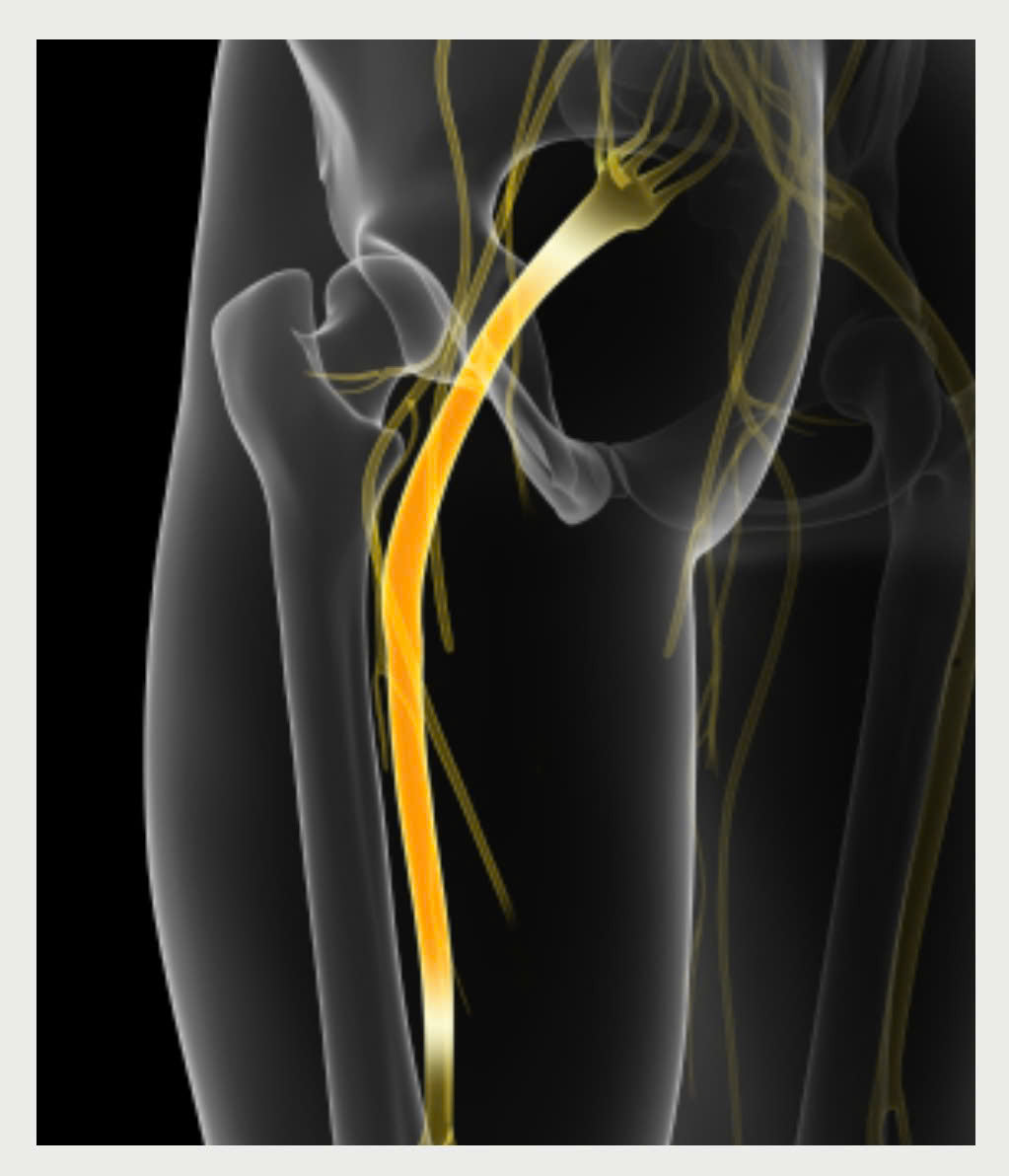 Back pain + sciatica guide