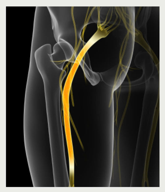 Back pain + sciatica guide